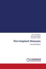 Peri-Implant Diseases