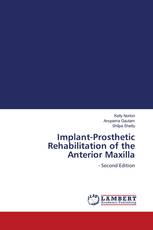 Implant-Prosthetic Rehabilitation of the Anterior Maxilla