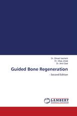 Guided Bone Regeneration