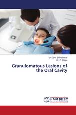 Granulomatous Lesions of the Oral Cavity