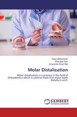 Molar Distalization