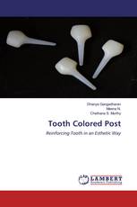 Tooth Colored Post
