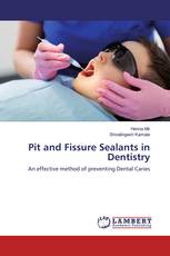 Pit and Fissure Sealants in Dentistry