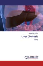 Liver Cirrhosis