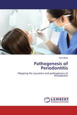 Pathogenesis of Periodontitis