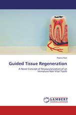 Guided Tissue Regeneration