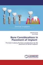 Bone Considerations in Placement of Implant