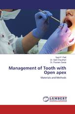 Management of Tooth with Open apex