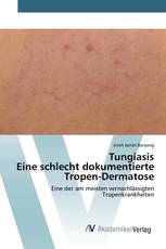 TungiasisEine schlecht dokumentierte Tropen-Dermatose