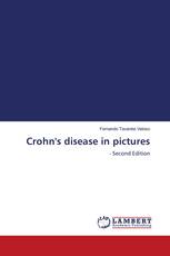 Crohn's disease in pictures