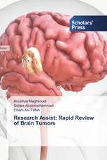 Research Assist: Rapid Review of Brain Tumors