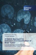 A Hybrid Approach for Detection and Classification of Brain Tumor