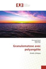 Granulomatose avec polyangéite