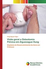 Visão geral e Osteotomia Pélvica em Ziguezague Hung