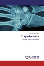 Trapeziectomy