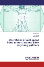 Operations of malignant bone tumors around knee in young patients