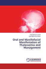 Oral and Maxillofacial Manifestation of Thalassemia and Management