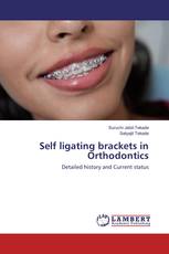Self ligating brackets in Orthodontics