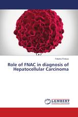 Role of FNAC in diagnosis of Hepatocellular Carcinoma
