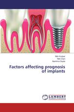 Factors affecting prognosis of implants