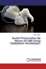 Socket Preservation By Means Of GBR Using "SANDWICH TECHNIQUE"