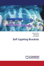 Self Ligating Brackets