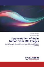 Segmentation of Brain Tumor From MRI Images