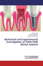 Numerical and experimental investigation of Ti/HA FGM dental implant