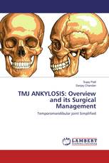 TMJ ANKYLOSIS: Overview and its Surgical Management