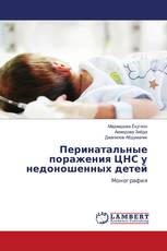 Перинатальные поражения ЦНС у недоношенных детей