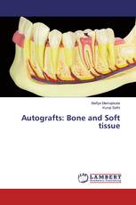 Autografts: Bone and Soft tissue