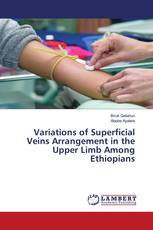 Variations of Superficial Veins Arrangement in the Upper Limb Among Ethiopians