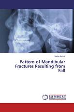 Pattern of Mandibular Fractures Resulting from Fall