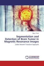 Segmentation and Detection of Brain Tumor in Magnetic Resonance Images