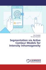 Segmentation via Active Contour Models for Intensity Inhomogeneity