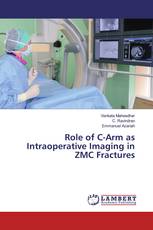 Role of C-Arm as Intraoperative Imaging in ZMC Fractures
