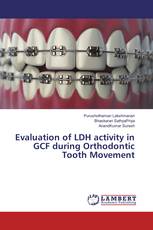Evaluation of LDH activity in GCF during Orthodontic Tooth Movement