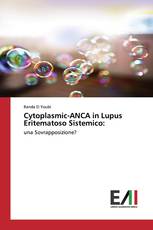 Cytoplasmic-ANCA in Lupus Eritematoso Sistemico: