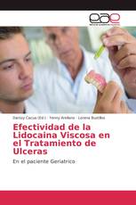 Efectividad de la Lidocaina Viscosa en el Tratamiento de Ulceras