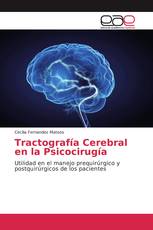 Tractografía Cerebral en la Psicocirugía