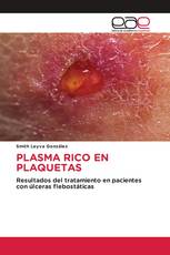 PLASMA RICO EN PLAQUETAS