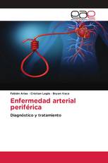 Enfermedad arterial periférica