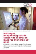 Hallazgos imagenológicos de cáncer de mama en mujeres menores 50 años