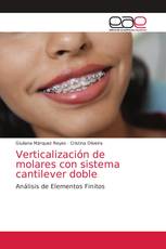 Verticalización de molares con sistema cantilever doble