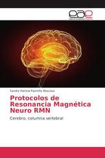 Protocolos de Resonancia Magnética Neuro RMN