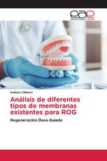 Análisis de diferentes tipos de membranas existentes para ROG