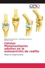 Células Mononucleares adultas en la osteoartritis de rodilla