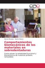 Comportamientos biomecánicos de los materiales en sobredentaduras