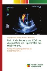 Raio X de Tórax mais ECG no diagnóstico de Hipertrofia em Hipertensos