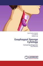Esophageal Sponge Cytology